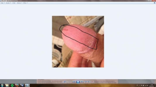 schmerzenpenis.jpg
