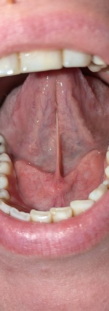 Mundraum 