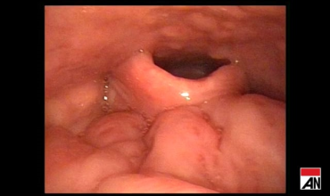1099898739_640x360_lead.jpg